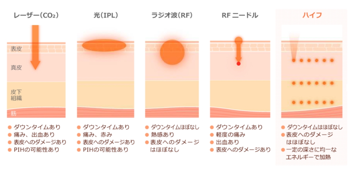 他の治療機器との違い